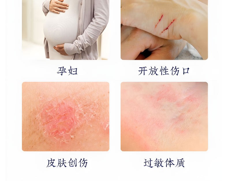 腰椎贴不适宜人群有哪些 腰椎贴不适宜人群有哪些