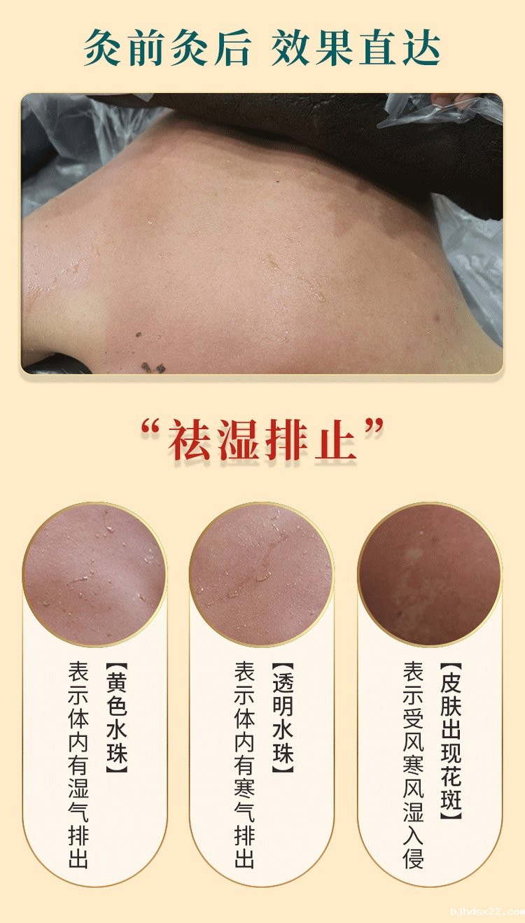 草本热灸膏使用效果对比 草本热灸膏使用效果对比