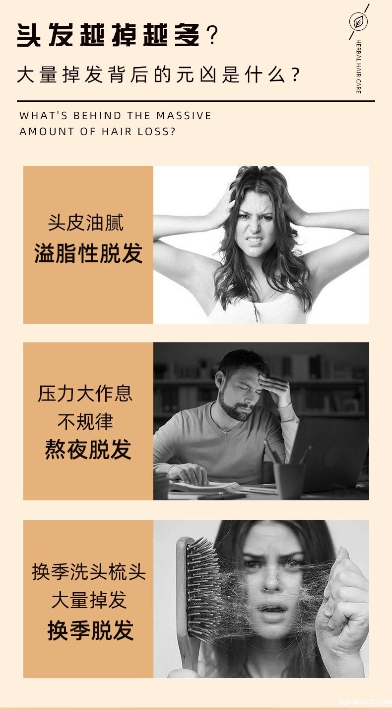 脱发原因 脱发原因