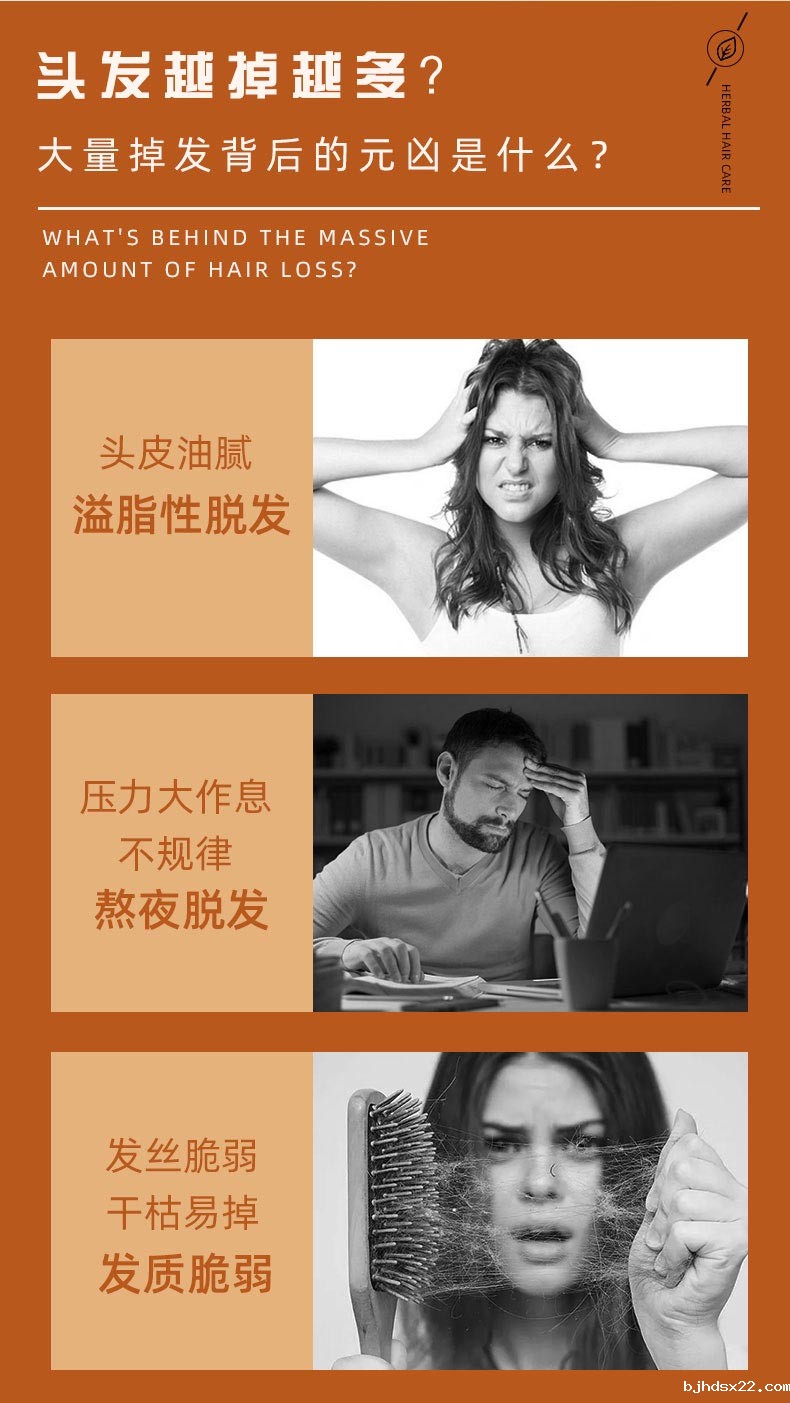 育发液适用人群 育发液适用人群